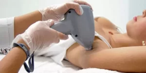 Read more about the article Vantagens da depilação a laser